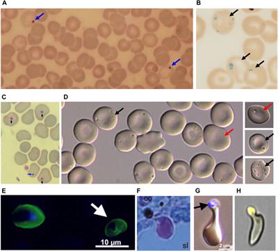 Intra-erythrocytic vacuoles in asplenic patients: elusive genesis and original clearance of unique organelles